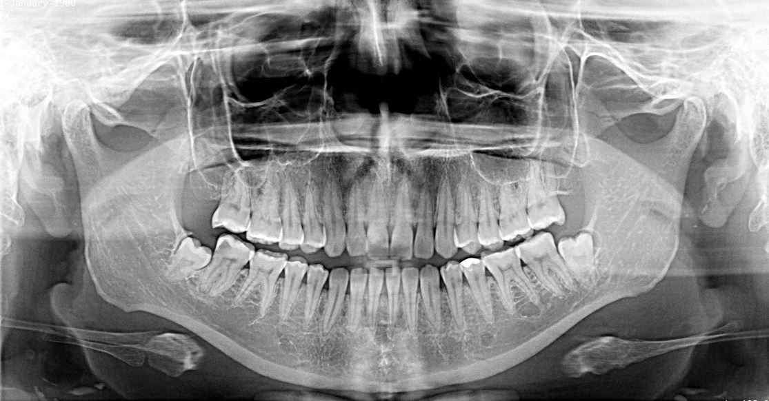 Radiologie dentară Râmnicu Sărat