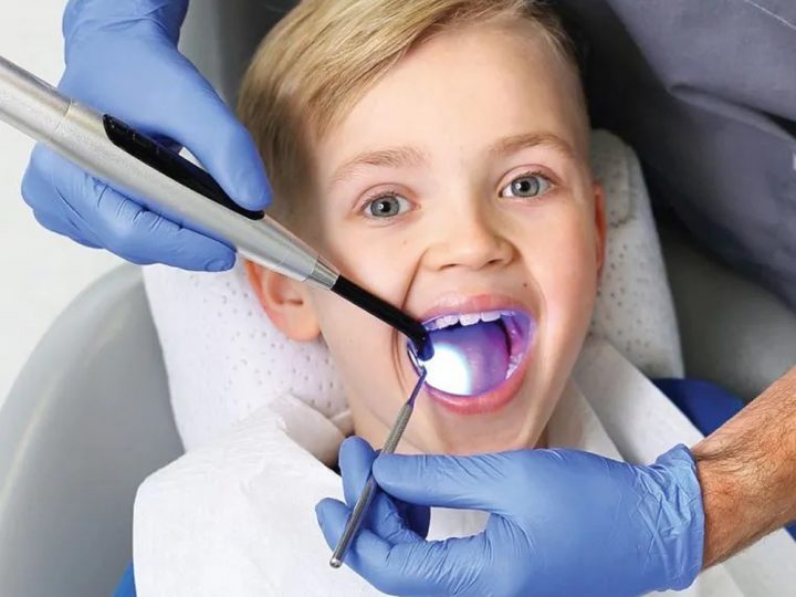 Totul despre sigilarea dentară la copii
